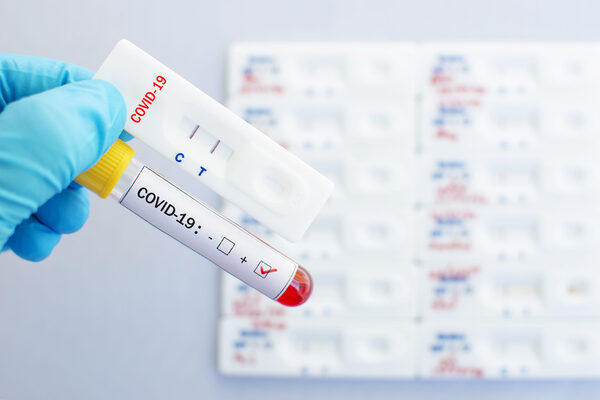 Corona-Schnelltest
